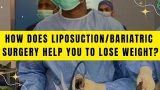  Is Liposuction/BBL Surgery and Weight Loss Surgery The Same?