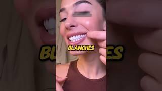 Voici comment avoir des dents toute blanche 