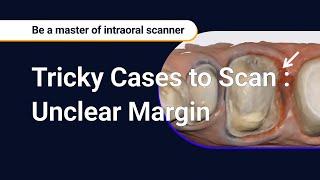 Tricky Cases to Scan : Unclear Margin