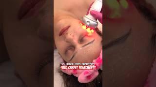 We tried this trending skin treatment and this happened  #badnews #trendingskincare Nehlaxmi Joshi