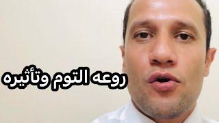 روعه التوم البلدي وتأثيره علي جسمنا