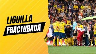 Liguilla fracturada: Más lesionados y dudas con América