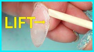 How To Spot and Treat A Nail Lift?