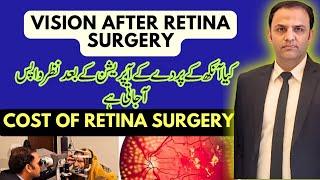 Retinal Detachment Treatment | Retinal Detachment Surgery #drfaisalanwar