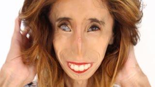 A Tribute Video To Lizzie Velasquez