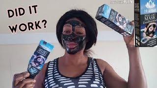 How To Remove Pimples Fast | Dead Sea Mud Peel Off Mask