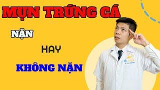 MỤN TRỨNG CÁ CÓ NÊN NẶN HAY KHÔNG| TREATMENT ACNE| DR.NGỌC