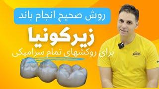 نحوه انجام باند زیرکونیا برای روکش دندان