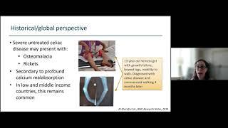 Building a Strong Foundation: Celiac Disease and Bone Health