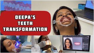 Transformation Of Deepa's Teeth Part-2 I Opaldentistry I invisible brace #sathishdeepa