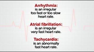 Heart Palpitations: When Is It Serious?