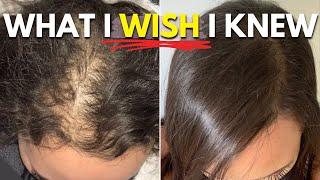 What I WISH I Knew About Hair Loss and Hair Growth Before It Was Too Late!!