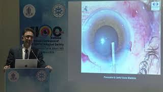 AIOC2024  GP225 Topic  Dr  Sajjad Hamid Fazili IFIS   Intraoperative Considerations