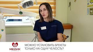 Можно установить брекеты только на одну челюсть?