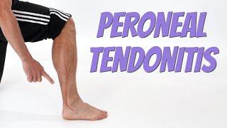 Peroneal Tendonitis (Side of Foot Pain), Causes & Self-Treatment.