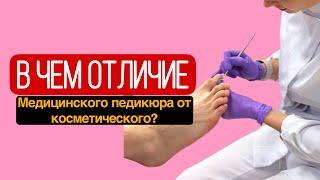 Как правильно выполнять медицинский педикюр Risiko Patient, пациентам с сахарным диабетом