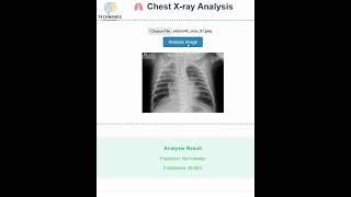 AI Chest X-Ray Diagnosis in Seconds 🩻 | 93% Accuracy | Medical Imaging Revolution #AI #Radiology