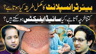 Hair Transplant Complete Method by Dr Muhmmad Salman | Hafiz Ahmed Podcast