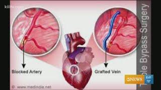 Coronary Artery Bypass Surgery and when it is appropriate for you