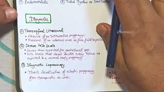 Ectopic pregnancy - Easy Handwritten Notes - Easy explanation in Hindi