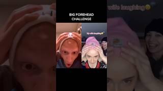 I have an INFINITY HEAD #comedy #funny #lol #alopecia #bald