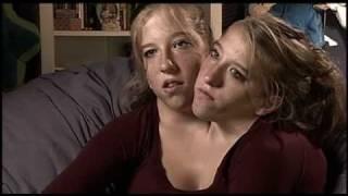 Abigail & Brittany Hensel - The Twins Who Share a Body