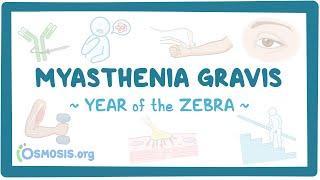 Myasthenia gravis (Year of the Zebra 2024)