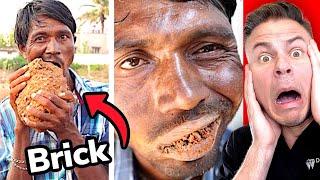 Orthodontist Reacts! Man Addicted To Eating Bricks!?