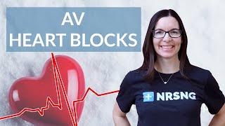 How to interpret AV Heart Blocks on an EKG strip