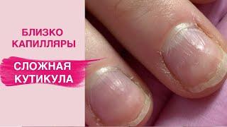 Сложная кутикула | Боязнь каждого мастера маникюра