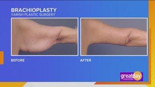 Wave goodbye to flabby arms with the help of Yarish Plastic Surgery