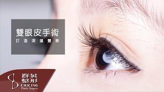 雙眼皮手術  │陳大正醫師│【群英整形】