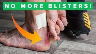 How to never get blisters again | Top 5 blister hacks
