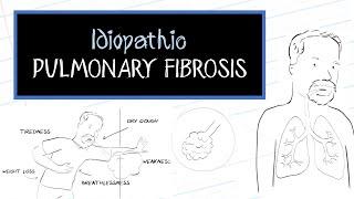 What is Idiopathic Pulmonary Fibrosis (IPF)?