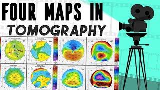 Maps in tomography || Corneal topography and tomography course || part 2 ||