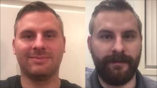 2 Month Beard Time Lapse