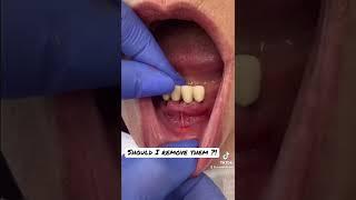 #tiktok #blogger  #video #dentist #fyp #viral #trending #foryou #family #foryou #love #blogger