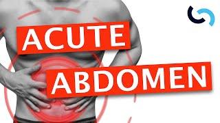 Acute Abdomen - Diagnosis and Management