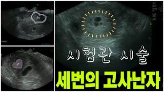 시험관시술 낮은피검수치
