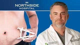 5 Things You Didn't Know About Bariatric Surgery With Dr. Charles Procter
