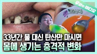 혈중 탄산 농도 초초초초과다 주의!!! 33년간 물 대신 탄산을 마셔온 남자 | Excessive Concentrations of SODA in His Blood!