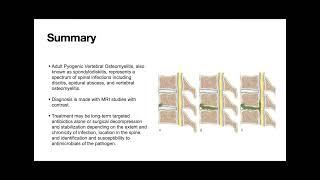 5/20/22 Spinal Infection: Osteomyelitis/ Discitis/ Epidural Abscess Lead by Dr. Lamping