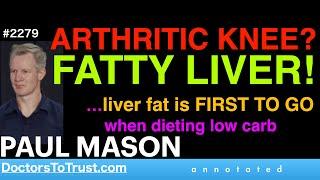 PAUL MASON o1 | ARTHRITIC KNEE? FATTY LIVER! …liver fat is FIRST TO GO when dieting low carb