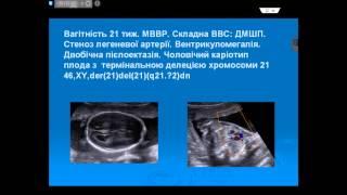 Конференция «Современные проблемы генетики и эпигенетики» Генетика и эпигенетика редких заболеваний.