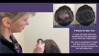 Hair Max Hair Loss Camouflage - Dr. Rogers - New Orleans