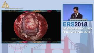 ERS London 2018, Improving Outcomes In Clival Chordomas; Total Or Subtotal Resection? Eric Wang