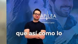 TESTIMONIO INJERTO CAPILAR/CAPILEA MEXICO