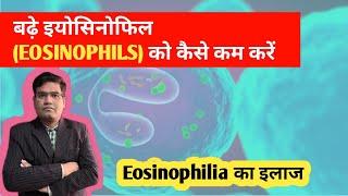 Eosinophilia का इलाज | Treatment of High Eosinophil in Blood..