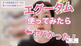 【話題の"まつ毛美容液エグータム"使ってみたら…ヤバい結果に！！】結果だけの動画