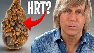 The Gallbladder gallstones HRT Thyroid Bloating connection- BILE affects everything!